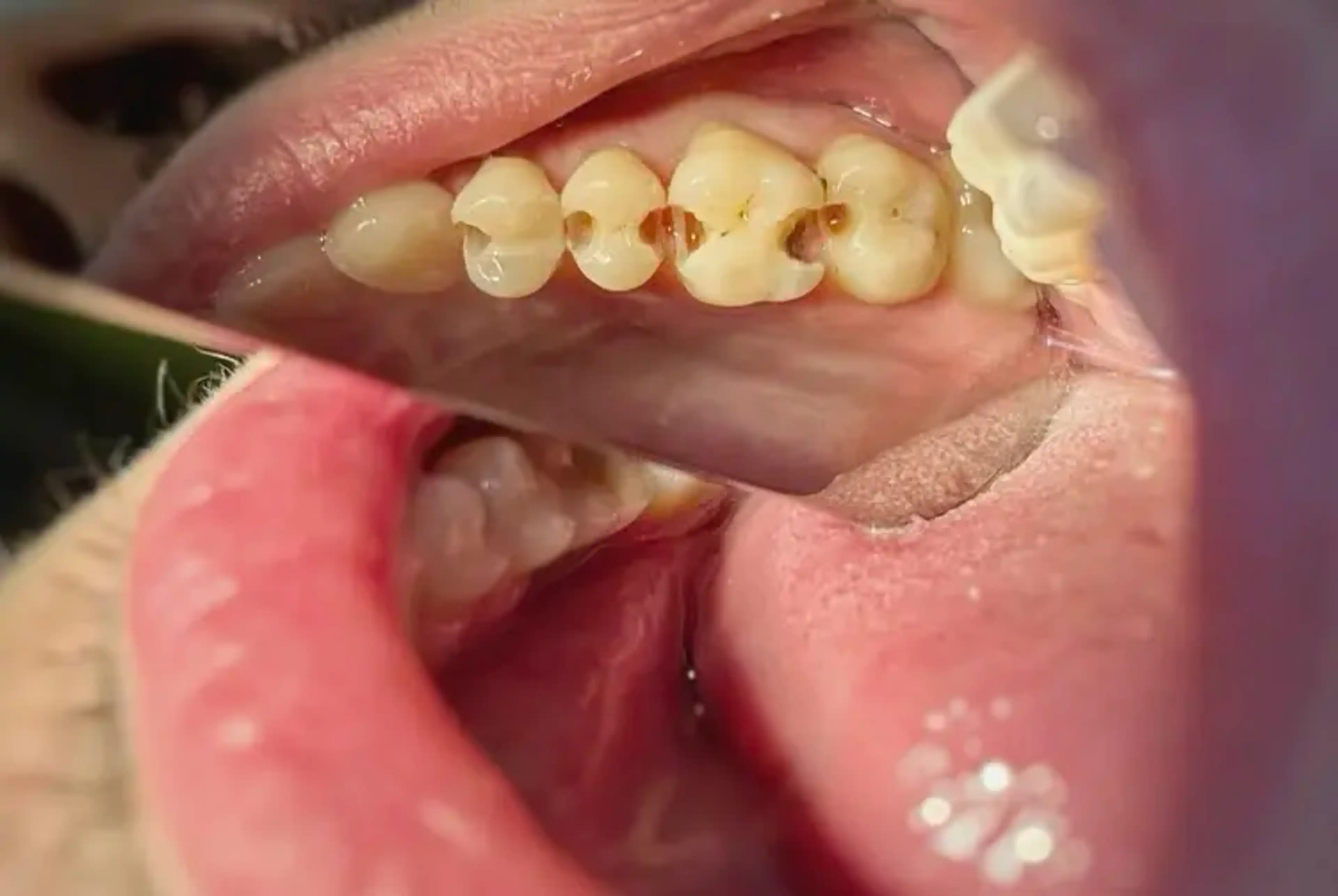 Înainte de tratament