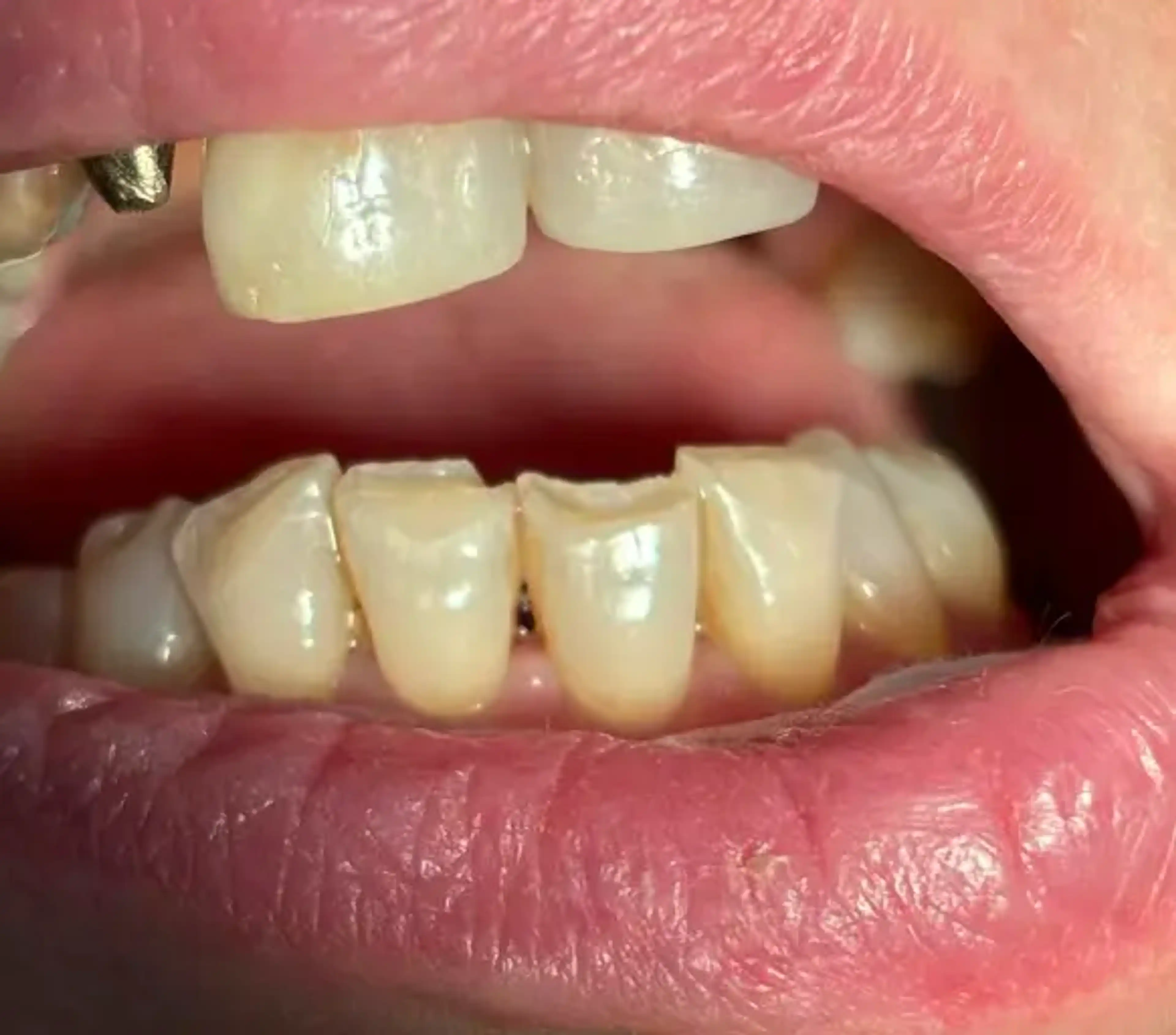 Înainte de tratament